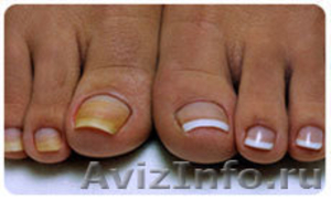 Обучение по курсу «Педикюр, наращивание ногтей на ногах» УЦ "Компания Солярис" - Изображение #1, Объявление #546659